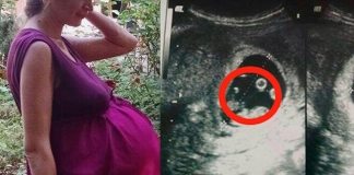 Когда женщину привезли в родильное отделение, врачи боялись к ней прикоснуться. Такого в их практике еще не было.