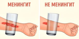 Родителям на заметку. 8 признаков менингита