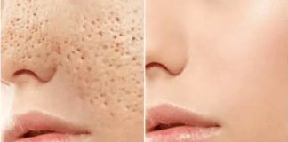 Хотите избавиться от пор на коже? Делайте одну из этих масок! Результат – через 3 дня!