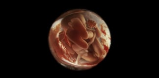 24 фото о том, что происходит внутри женщин все 9 месяцев беременности