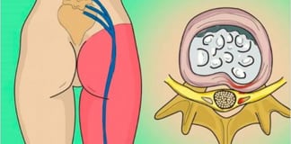 Вы этого не знали точно: достаточно делать одно упражнение для седалищного нерва, чтобы забыть о болях в пояснице!