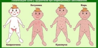 10 детских болезней, которые должны уметь отличать все родители