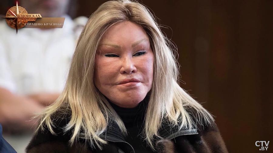 Людмила Гурченко, Маргарита Терехова, Нонна Мордюкова и даже самый известный министр СССР Екатерина Фурцева без страха и сомнения ложились под скальпель с одной единственной целью – стать моложе и...-18