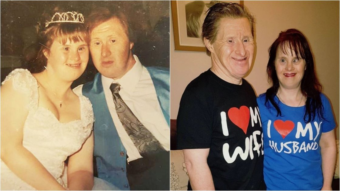 29 лет назад состоялась первая свадьба людей с синдромом Дауна. Как сложилась их судьба