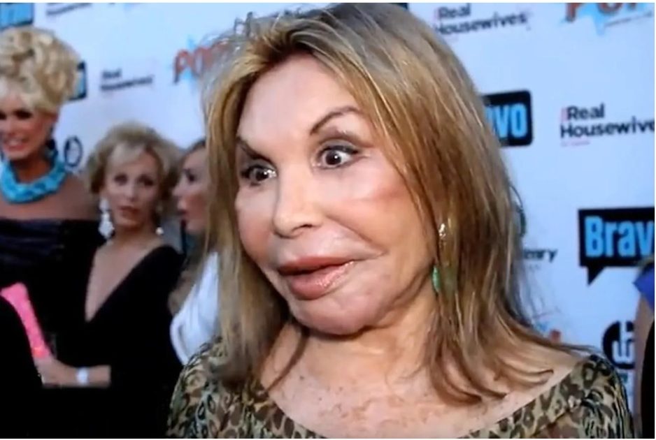 Пластика уничтожила их внешность. Когда денег много