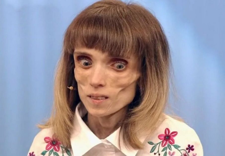 Боялась поправиться: Как выглядит теперь 17-килограммовая Кристина Корягина, которая приходила на выпуск Пусть говорят