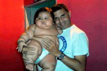 Малышу Сантьяго, весившему в 8 месяцев более 20 кг., уже почти 9 лет. Как он выглядит