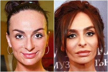 19 известных женщин до пластики и после - а есть ли разница в лучшую сторону, или им стоило оставить как было - сравниваем