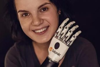 Маргарита Грачева, изувеченная бывшим мужем, вышла замуж, как выглядит девушка сейчас и фото со свадьбы.