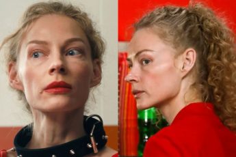 Когда худоба не к лицу: "новые" лица 7 российских селебрити в погоне за модой