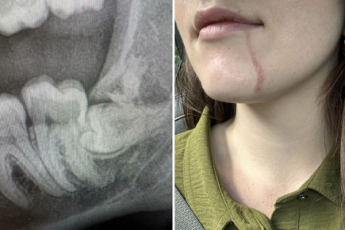 12 фото неудач, которые доказывают, что у вас был не такой уж плохой день