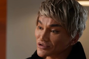 Пластический хирург, оперирующий звёзд, сам пострадал в результате неудачной операции. Как изменилась внешность знаменитого врача