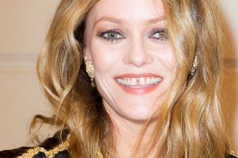 Знаменитости, которые превратили свои недостатки в достоинства