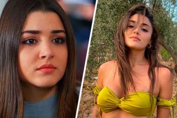 Как выглядят знаменитости до и после пластики? 8 удачных и не очень примеров