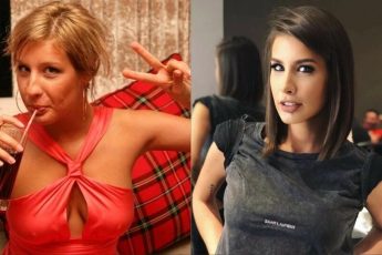 20 фото звезд, доказывающих, что их красота подарена вовсе не природой