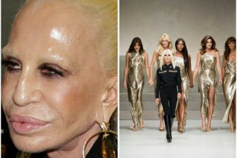 Как Донателла Версаче вернула себе нормальное лицо после неудачной пластики?