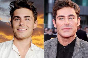 Звёздные красавцы, которые сделали пластику. И стали выглядеть хуже