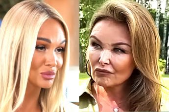 "Лисьи глазки, пёсий носик": новые лица наших селебрити после свежих пластических операций